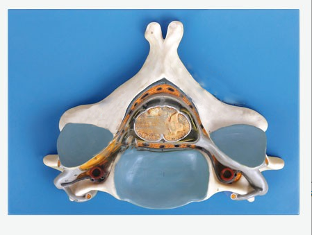 脊髓橫斷模型（第五頸椎附脊髓和脊神經(jīng)放大模型）